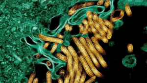 Deadly Ebola outbreak hits DR Congo