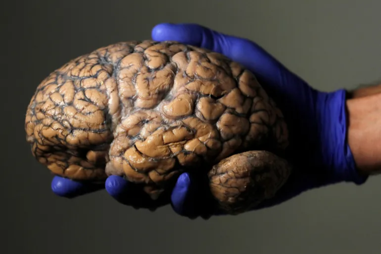Study Says Human Brain May Not Mature Until 32